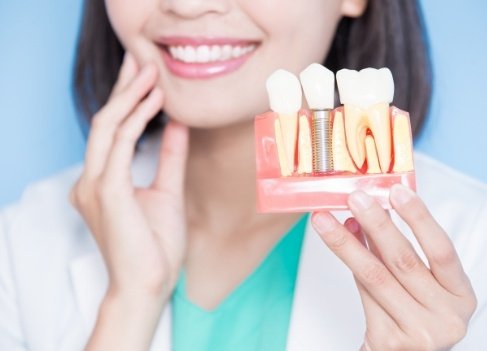 Model smile used to explain root canal treatment